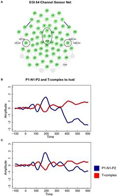 Language Experience with a Native-Language Phoneme Sequence Modulates the Effects of Attention on Cortical Sensory Processing